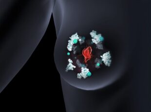 3D-tolkning av ett bröst med cancerceller i rött, proteiner i vitt samt kopparjoner i grönt