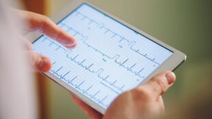 EKG som visar hjärtats rytm visas på en läsplatta.