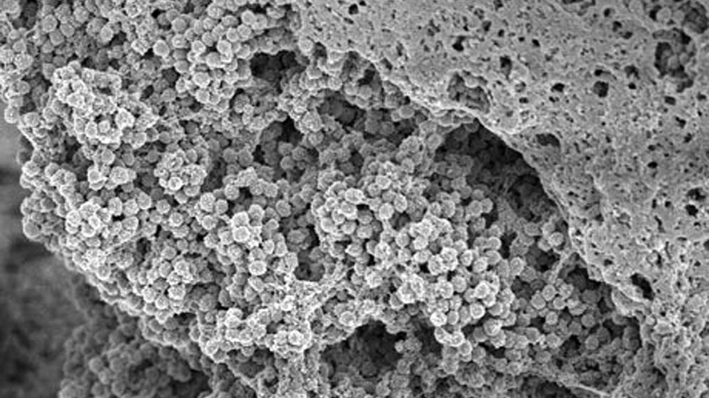 Mikroskopbild av biofilm skapad av S. aureus bacteria.