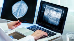 Läkare bedömer bilder från mammografi
