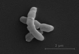 Bakterien Propionibacterium acnes sedd genom elektronmikroskop. (Bild: Matthias Mörgelin, Lunds universitet)