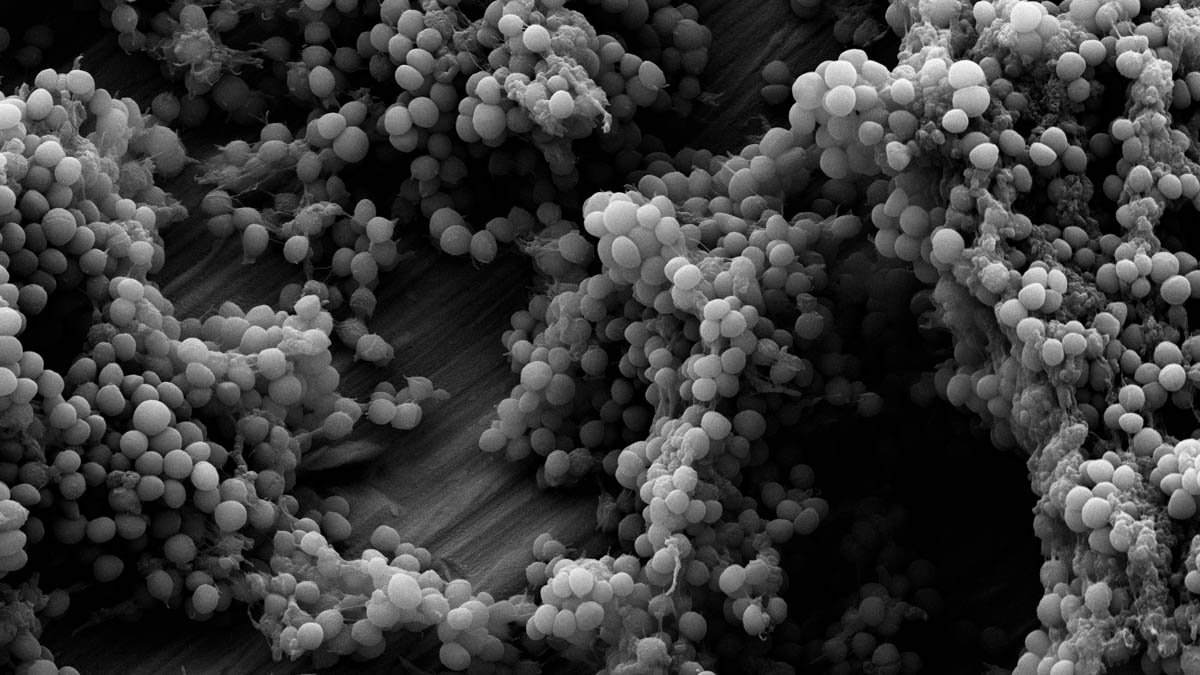 Den kulformade bakterien Staphylococcus epidermidis växer i små högar på substrat av titan.