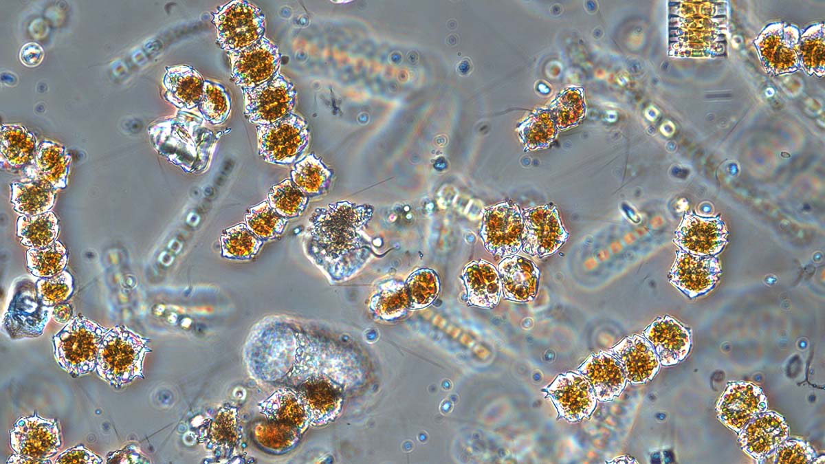 Mikroskopbild av växtplankton i olika storlekar.