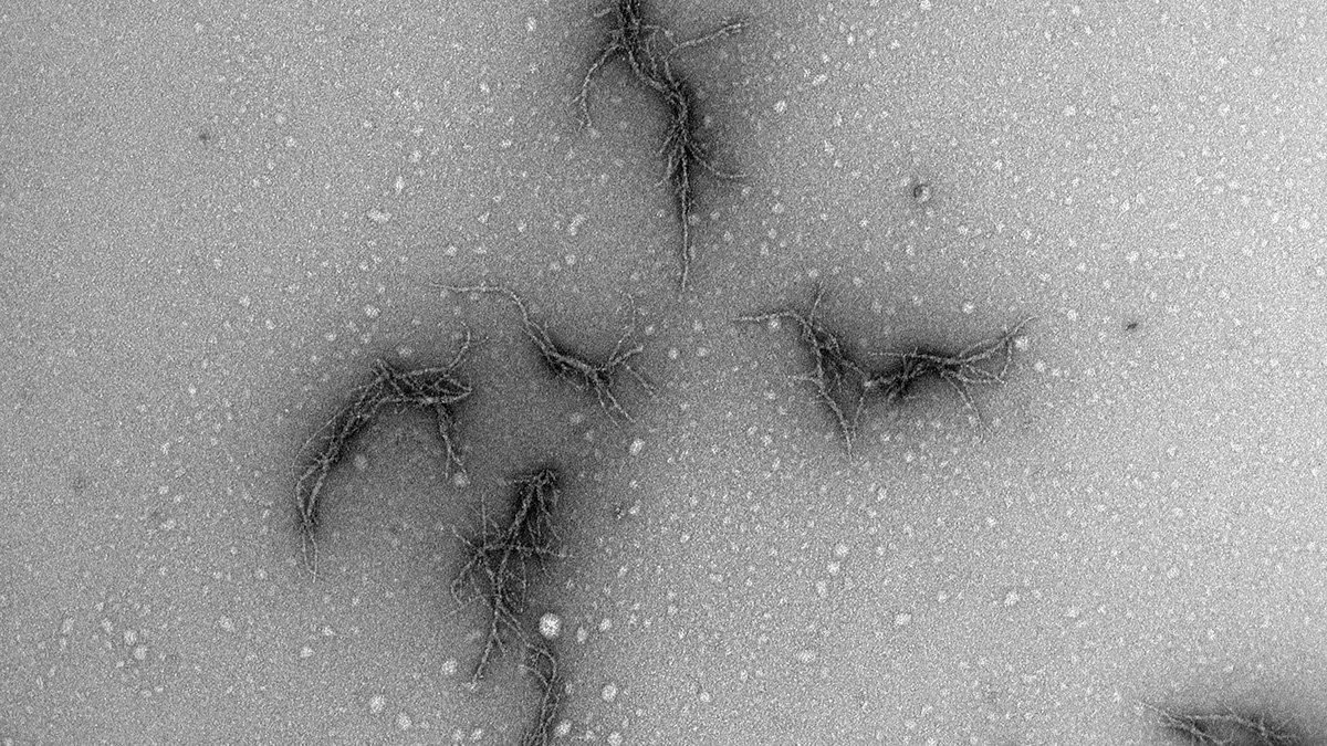 Elektronmikroskopibild av amyloid från sars-cov-2-virusets spikprotein.