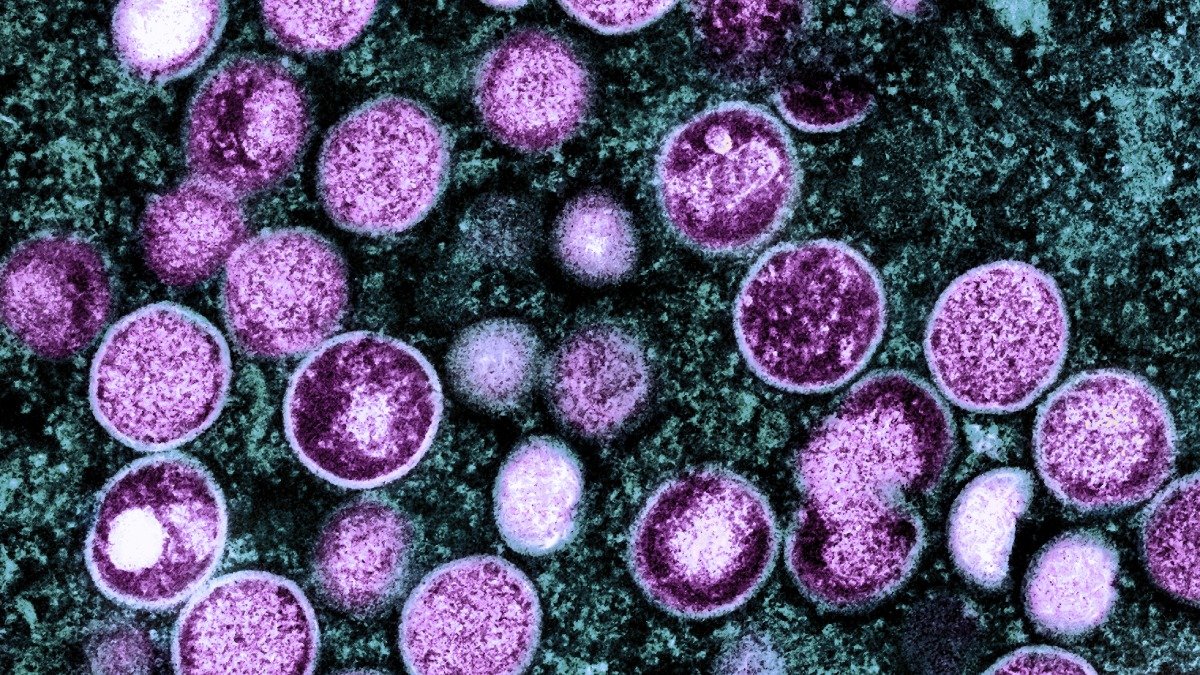 Mikroskopbild av virus inuti lila celler