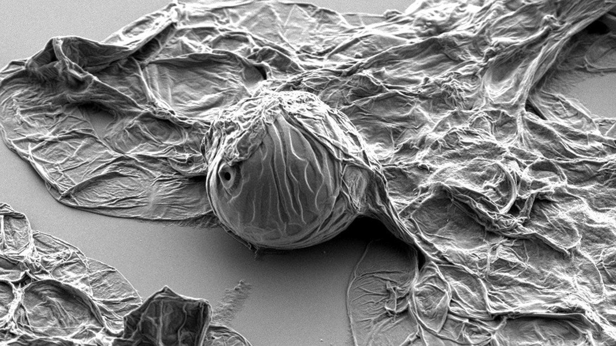 Ett svartvitt foto av en växtcell sedd i ett mikroskop.