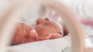 Extremt för tidigt födda bebisar kan behöva tillskott av ett protein för att slippa hjärnblödning, liten bebis sover i kuvös med slang in i näsan.