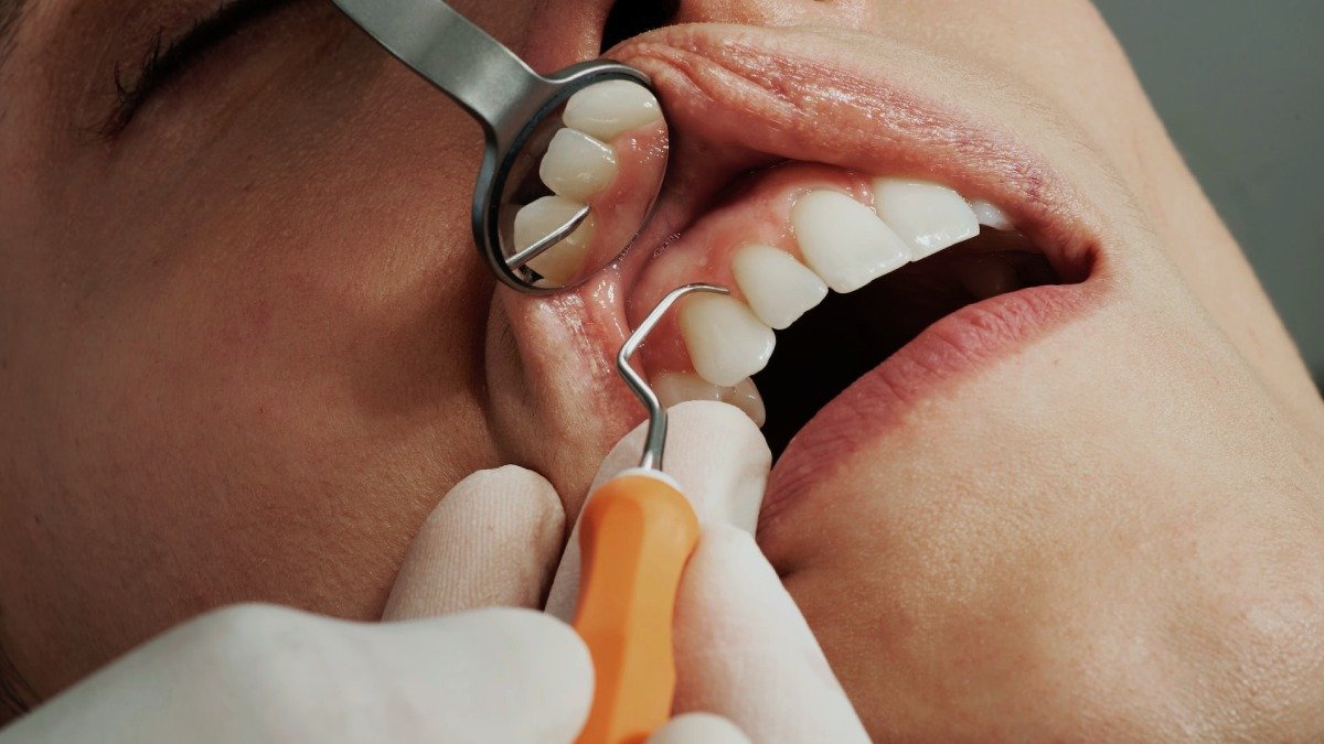 tander som undersöks