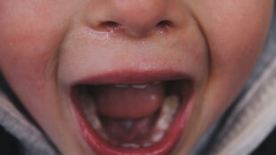 Närbild på näsa och mun hos ett barn som skriker.