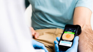 Läkare med app och patient. På skärmen ses en hudförändring med information.
