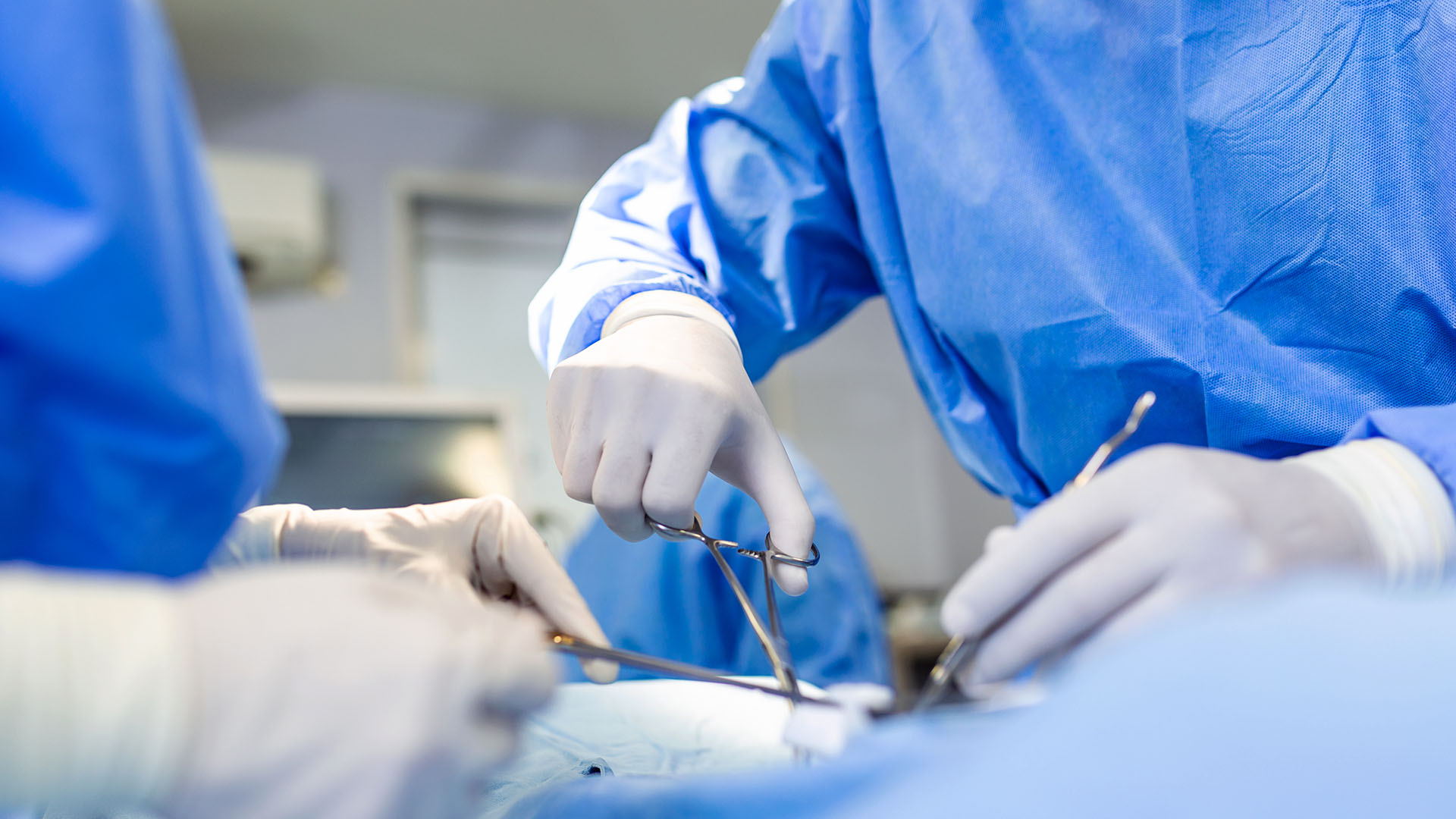 Un intervento chirurgico limitato può ridurre il gonfiore dopo il cancro al seno